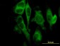 GSDMDC1 Antibody (monoclonal) (M01)